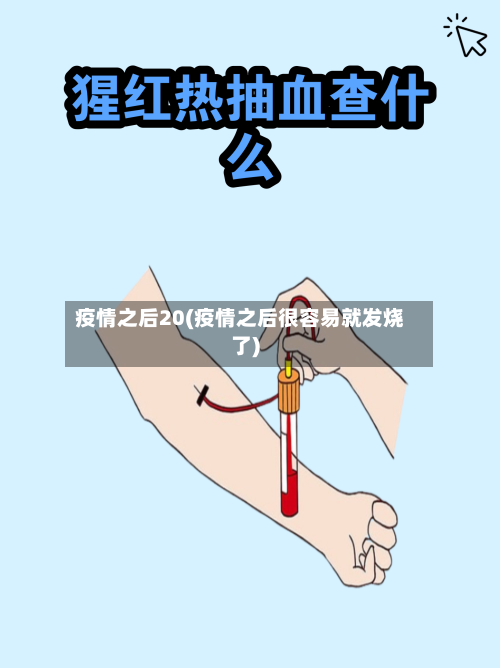 疫情之后20(疫情之后很容易就发烧了)-第2张图片
