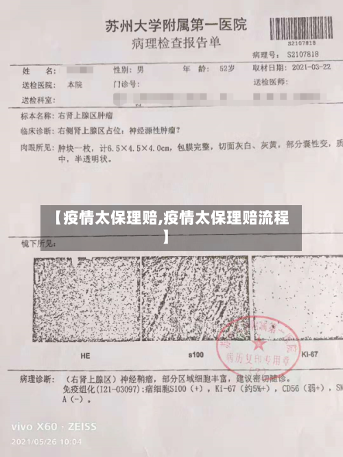 【疫情太保理赔,疫情太保理赔流程】-第2张图片
