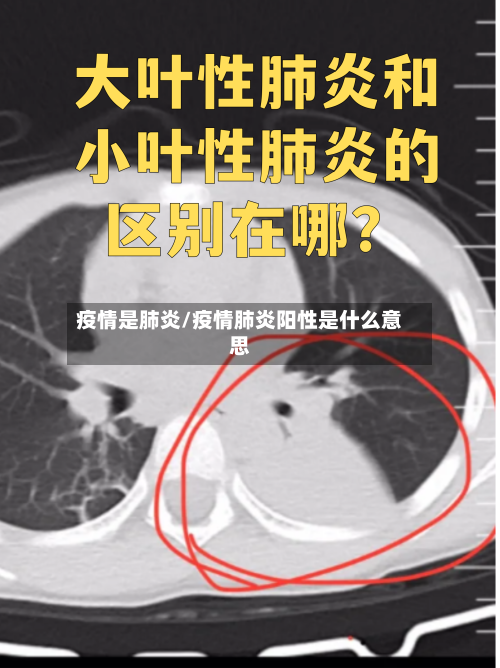 疫情是肺炎/疫情肺炎阳性是什么意思