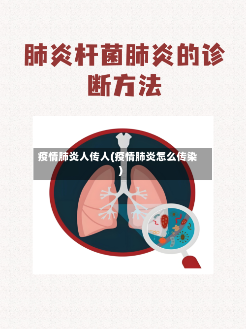 疫情肺炎人传人(疫情肺炎怎么传染)-第3张图片