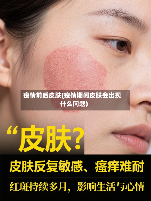 疫情前后皮肤(疫情期间皮肤会出现什么问题)
