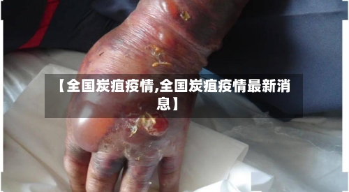 【全国炭疽疫情,全国炭疽疫情最新消息】-第3张图片