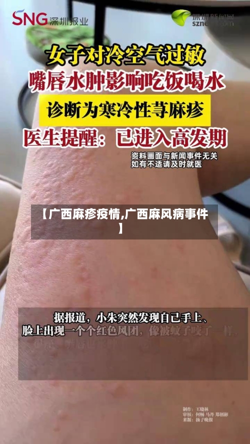 【广西麻疹疫情,广西麻风病事件】