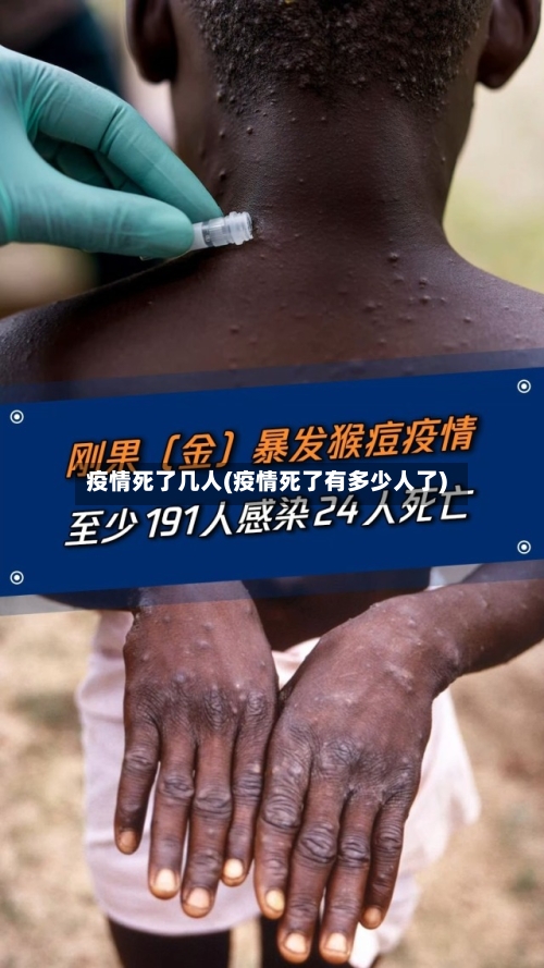 疫情死了几人(疫情死了有多少人了)