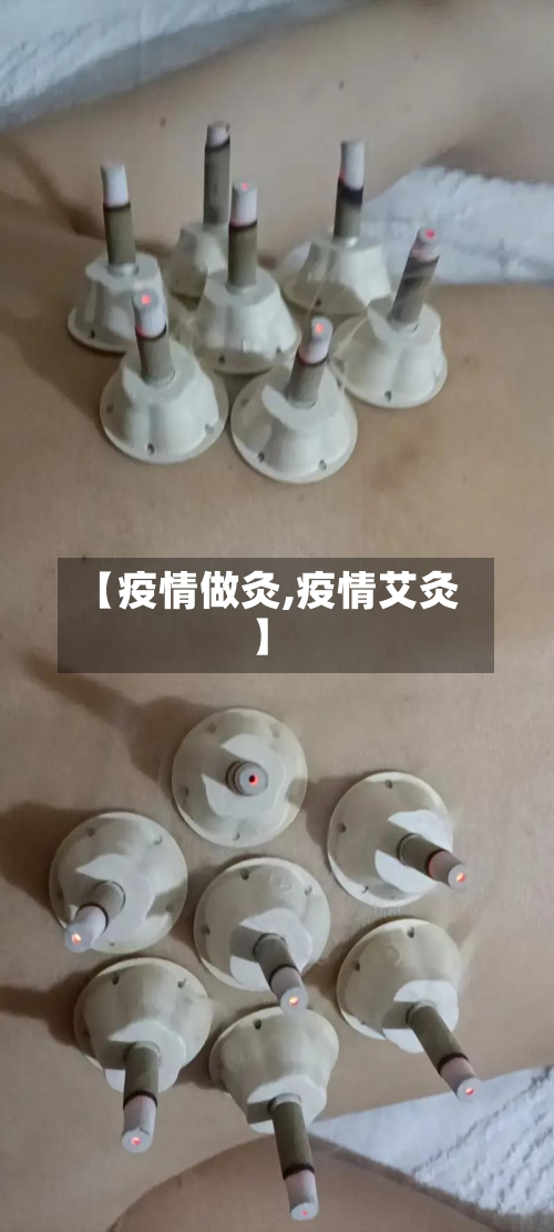 【疫情做灸,疫情艾灸】