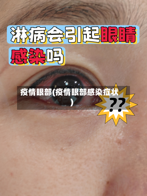疫情眼部(疫情眼部感染症状)