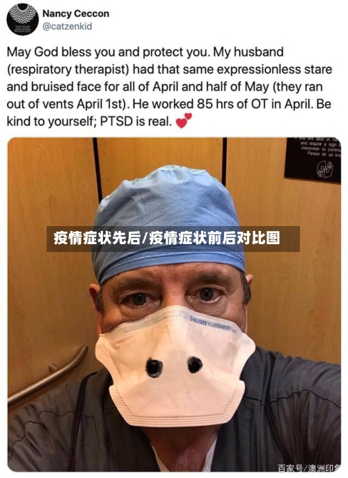 疫情症状先后/疫情症状前后对比图