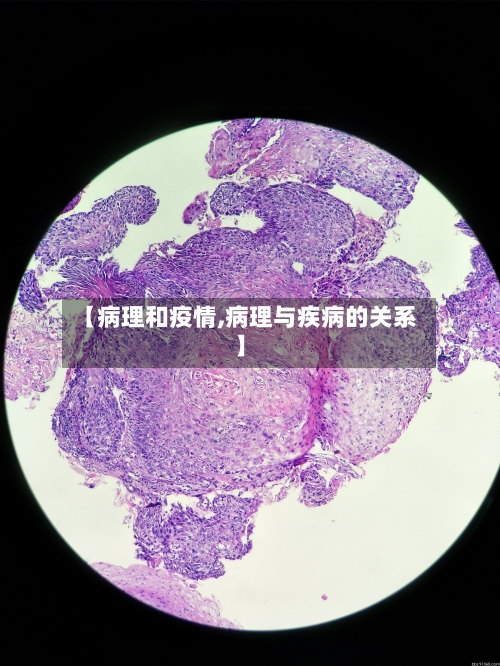 【病理和疫情,病理与疾病的关系】