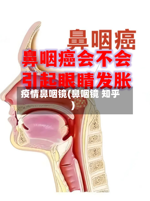 疫情鼻咽镜(鼻咽镜 知乎)