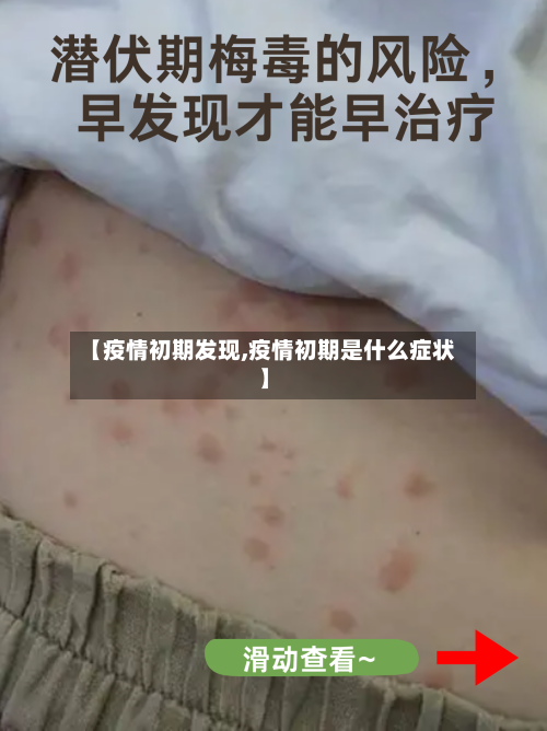 【疫情初期发现,疫情初期是什么症状】