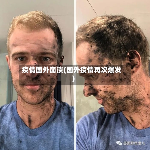 疫情国外崩溃(国外疫情再次爆发)