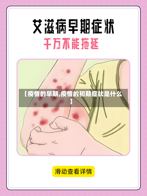 【疫情的早期,疫情的初期症状是什么】