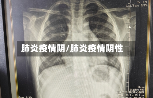 肺炎疫情阴/肺炎疫情阴性