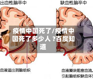 疫情中国死了/疫情中国死了多少人 ?百度知道