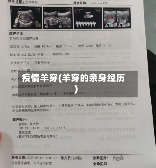 疫情羊穿(羊穿的亲身经历)