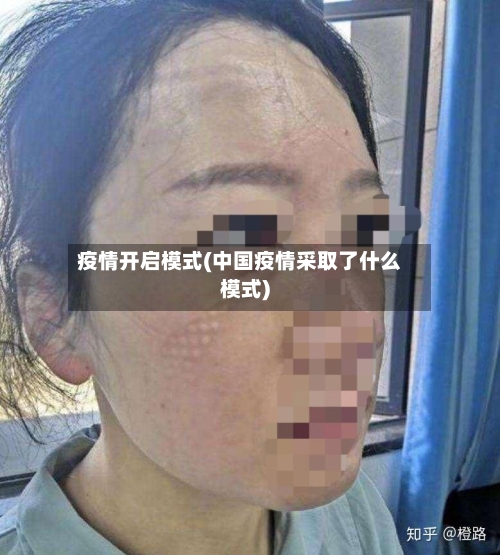 疫情开启模式(中国疫情采取了什么模式)