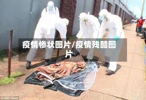 疫情惨状图片/疫情残酷图片