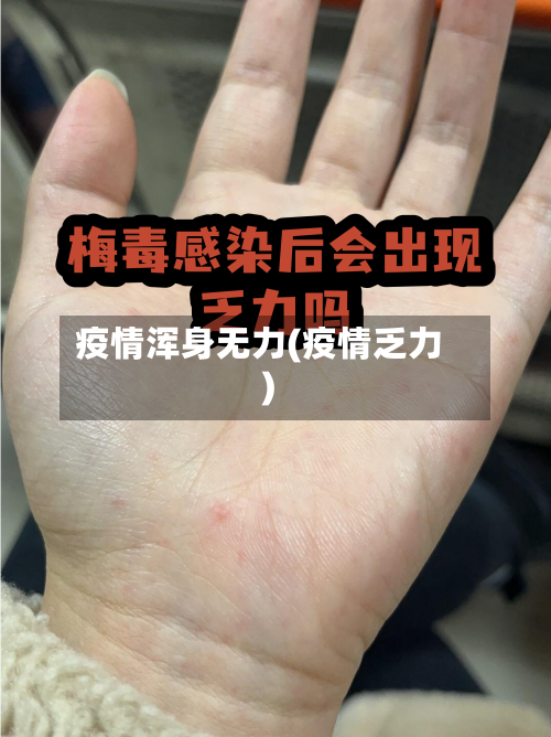 疫情浑身无力(疫情乏力)