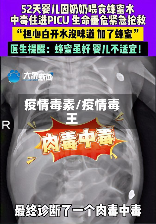 疫情毒素/疫情毒王