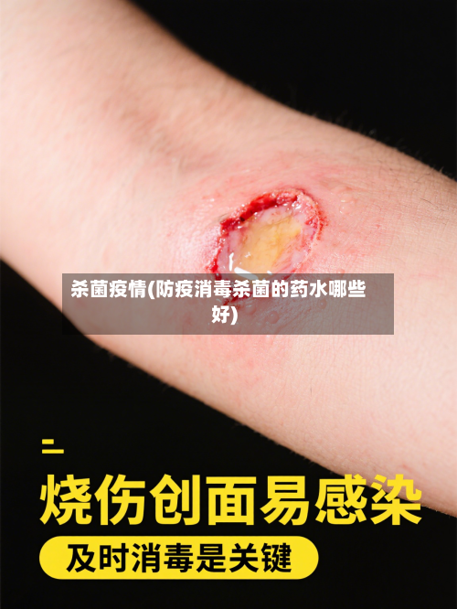 杀菌疫情(防疫消毒杀菌的药水哪些好)
