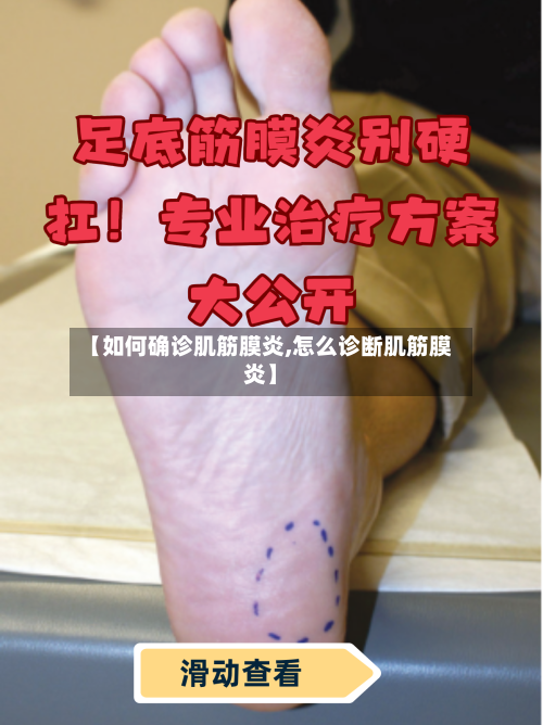【如何确诊肌筋膜炎,怎么诊断肌筋膜炎】