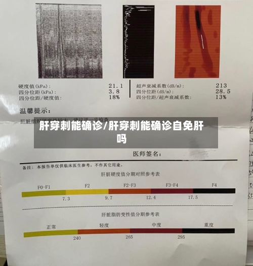 肝穿刺能确诊/肝穿刺能确诊自免肝吗