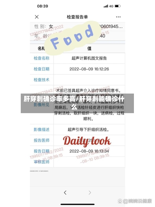 肝穿刺确诊率多高/肝穿刺能确诊什么