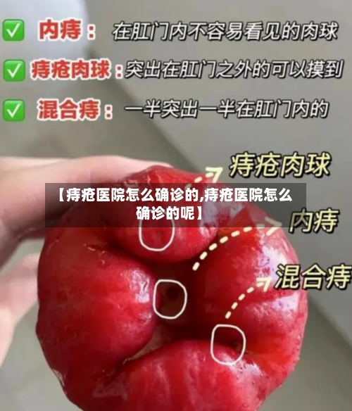 【痔疮医院怎么确诊的,痔疮医院怎么确诊的呢】