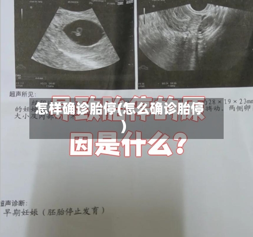 怎样确诊胎停(怎么确诊胎停)