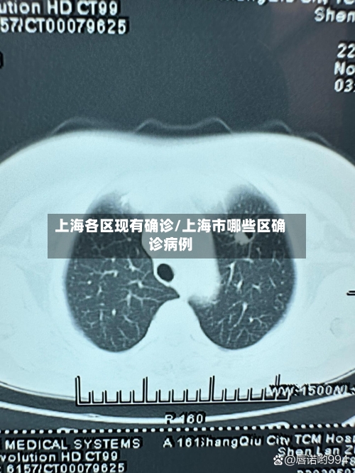 上海各区现有确诊/上海市哪些区确诊病例