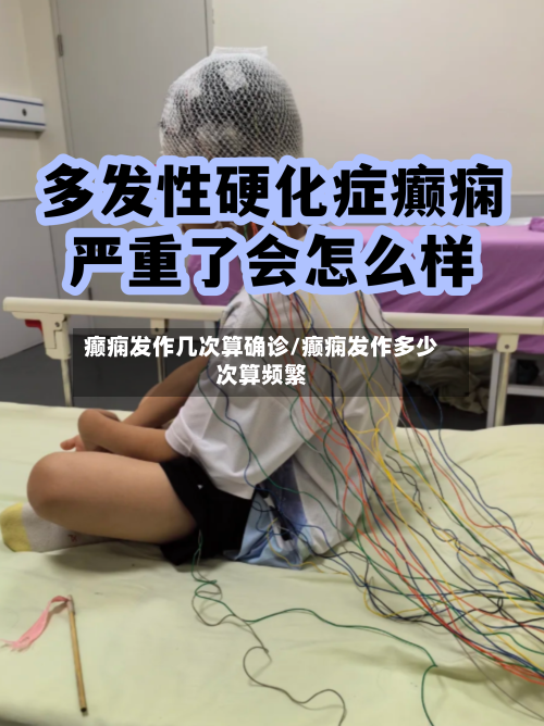 癫痫发作几次算确诊/癫痫发作多少次算频繁