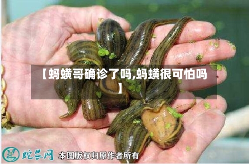 【蚂蟥哥确诊了吗,蚂蟥很可怕吗】