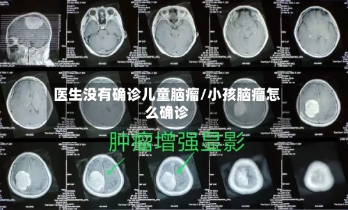 医生没有确诊儿童脑瘤/小孩脑瘤怎么确诊