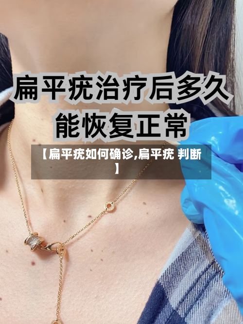 【扁平疣如何确诊,扁平疣 判断】