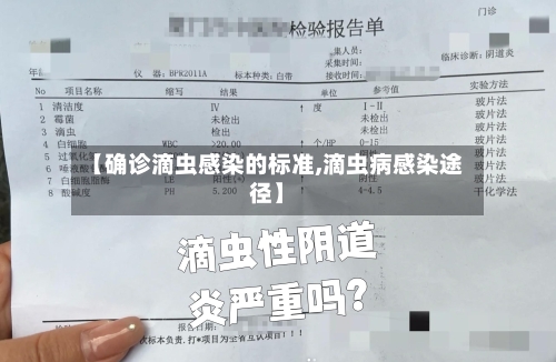 【确诊滴虫感染的标准,滴虫病感染途径】