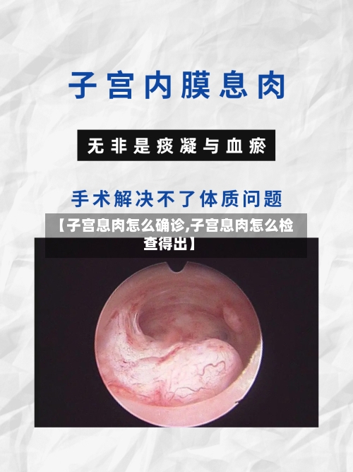 【子宫息肉怎么确诊,子宫息肉怎么检查得出】