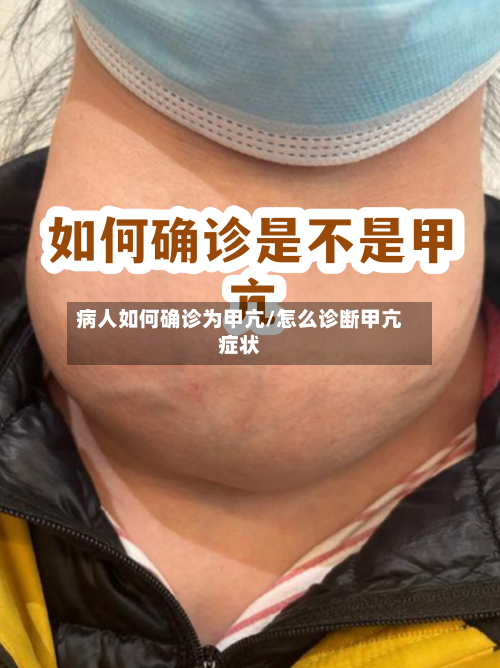 病人如何确诊为甲亢/怎么诊断甲亢症状