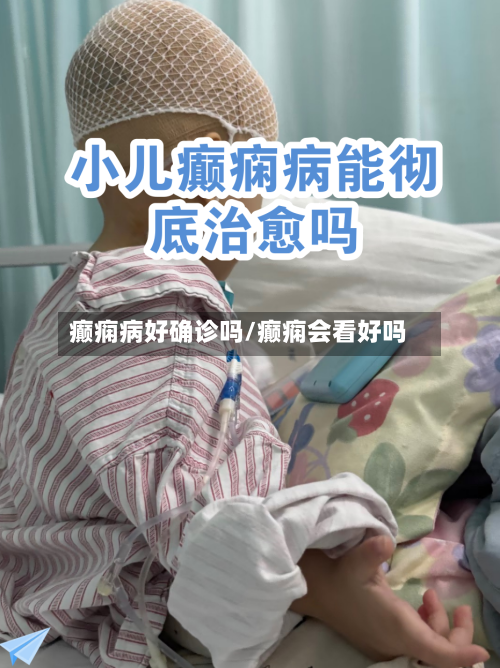 癫痫病好确诊吗/癫痫会看好吗