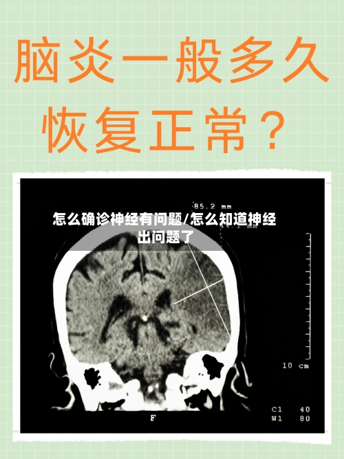 怎么确诊神经有问题/怎么知道神经出问题了