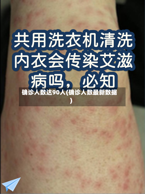 确诊人数达90人(确诊人数最新数据)