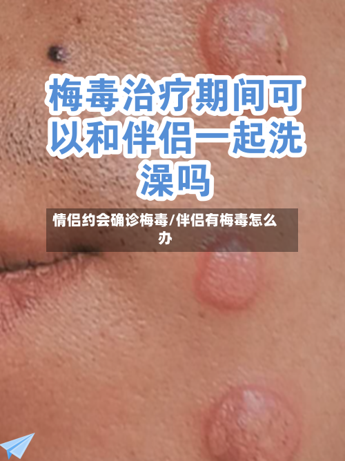 情侣约会确诊梅毒/伴侣有梅毒怎么办
