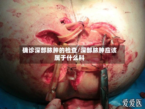 确诊深部脓肿的检查/深部脓肿应该属于什么科