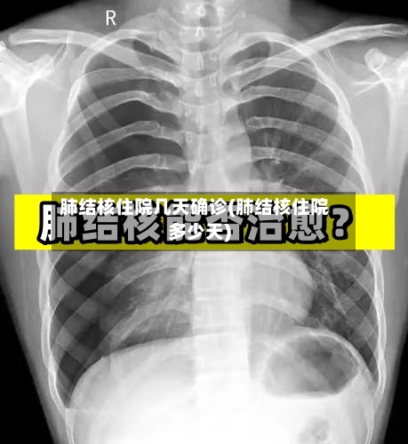 肺结核住院几天确诊(肺结核住院多少天)