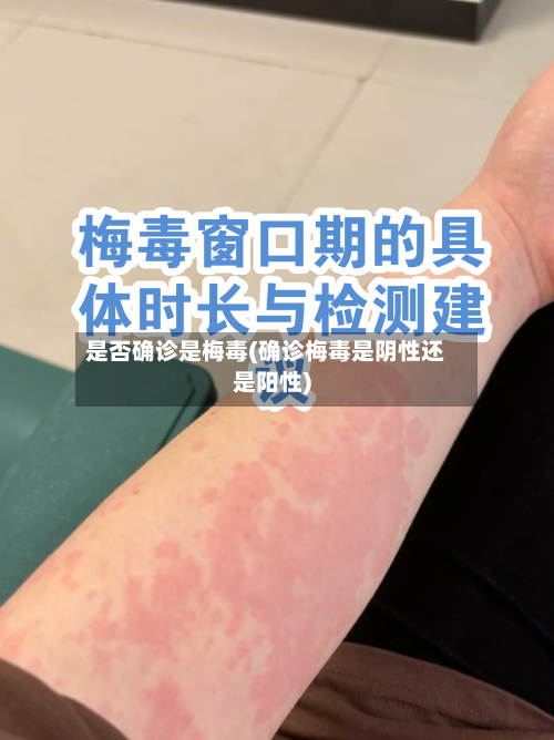 是否确诊是梅毒(确诊梅毒是阴性还是阳性)