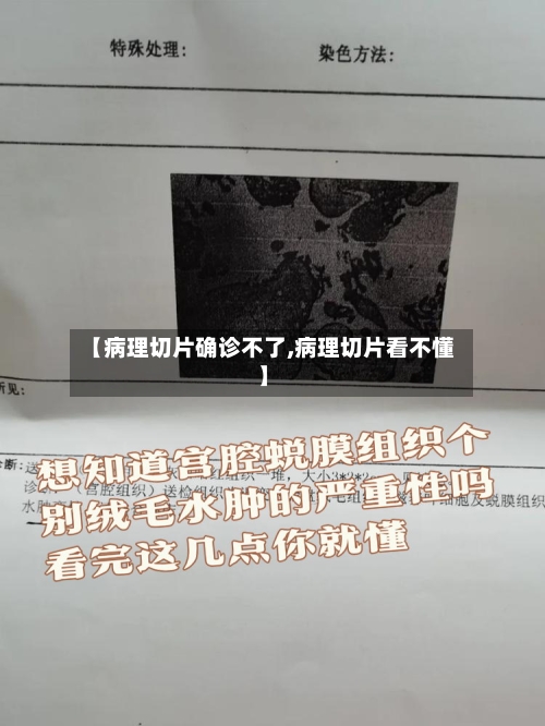 【病理切片确诊不了,病理切片看不懂】