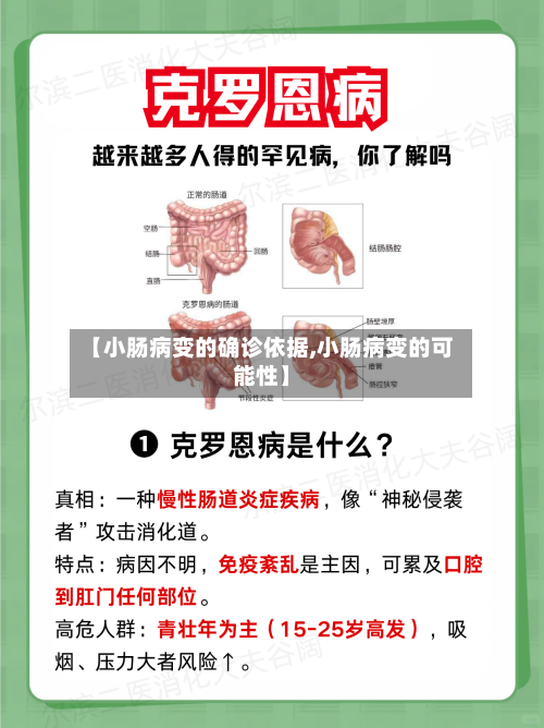 【小肠病变的确诊依据,小肠病变的可能性】