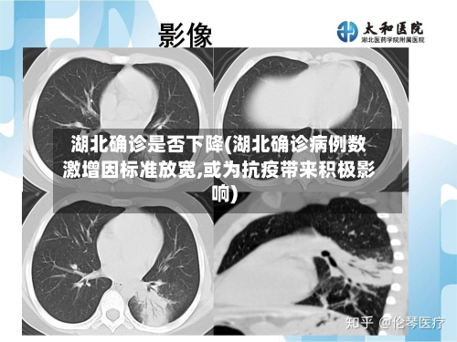 湖北确诊是否下降(湖北确诊病例数激增因标准放宽,或为抗疫带来积极影响)