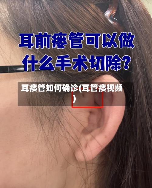 耳瘘管如何确诊(耳管瘘视频)