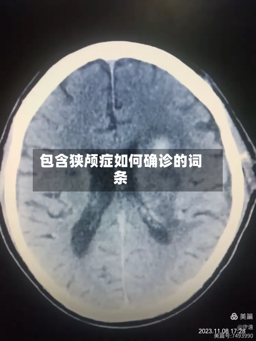 包含狭颅症如何确诊的词条