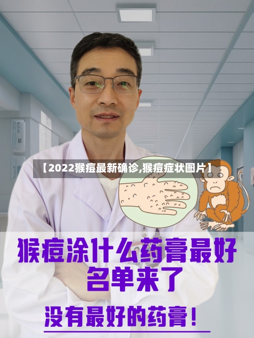 【2022猴痘最新确诊,猴痘症状图片】